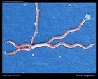 Borrelia burgdorferi  electron microscopy